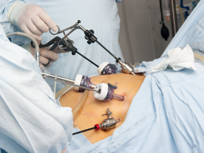 Laparoscopic Surgery