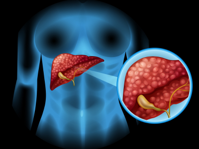 Liver Disease Care