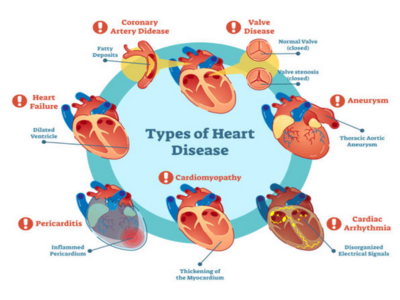 Medical Management of Heart Diseases